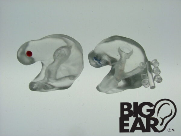 BackBeat Custom Adapters